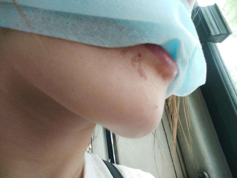 2023成都線雕祛除法令紋權(quán)威醫(yī)生榜單前十名(鐘正強(qiáng)、向雪岑、辜璐仙資料公開任你挑！)