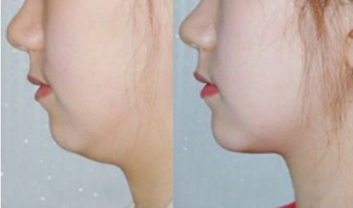 山東臨沂整容醫(yī)院排行榜及綜合評價：哪家好？