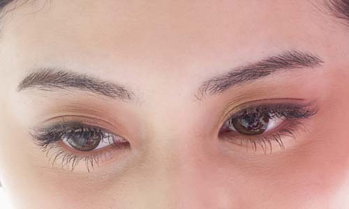 北京葉子整形醫(yī)院魯禮新割雙眼皮的效果如何？