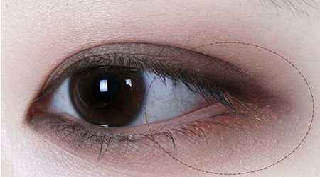 2023濟(jì)南5s重瞼術(shù)權(quán)威醫(yī)生口碑TOP10(于杰、張義晨、王標(biāo)多方面出擊入圍榜單)