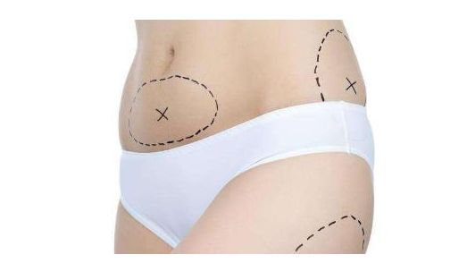 上海哪家醫(yī)院的祛眼袋手術(shù)效果最好？讓您的眼睛重獲明亮與青春