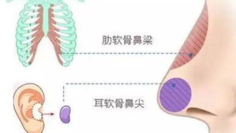 廣州有哪些醫(yī)院可以進(jìn)行抽脂手術(shù)？