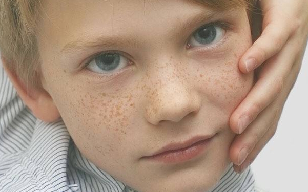 2023泰安鮮紅斑痣去除口碑榜前10名的醫(yī)生(李文志、朱兆春、李春明公立私立靠譜合集)