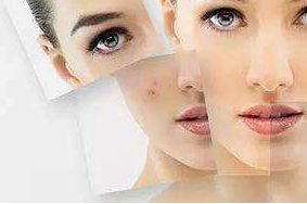 上海哪家醫(yī)院祛太田痣效果最佳？