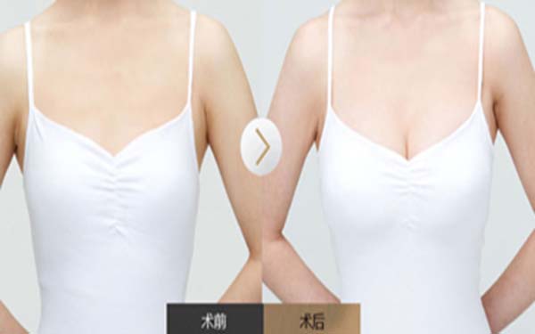 2023上海做內(nèi)切眼袋手術(shù)正規(guī)醫(yī)生評分前10位(唐玲、馬昌華、馬麗人氣醫(yī)生變美不踩雷~)