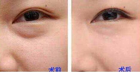 杭州整形美容界大咖PK，曾海峰、河?xùn)|鎬、高俊明，想知道磨骨哪個(gè)醫(yī)生靠譜？