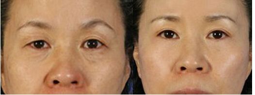 南京硅膠隆鼻哪家醫(yī)院好？斯景醫(yī)療專家推薦！