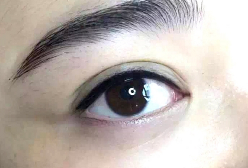 武漢唇腭裂手術(shù)專家推薦！精選專家名單，1期2期修復(fù)全搜羅！