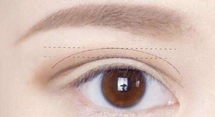 杭州劉軍鼻子塑形效果如何？個(gè)人簡介、醫(yī)院、費(fèi)用詳情先給您解答