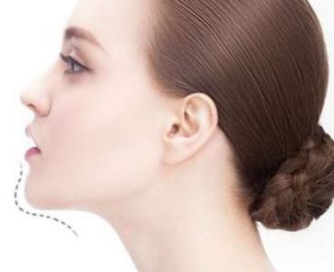 2023長(zhǎng)沙玻尿酸填充眼角紋正規(guī)醫(yī)生10強(qiáng)(楊興華、張瓊、舒艷強(qiáng)烈推薦！)