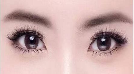 南寧自體填充淚溝哪家好？探索最佳南寧自體填充淚溝選擇