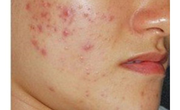 想了解寧波慈溪圣愛醫(yī)院醫(yī)療美容整形科價(jià)格表？醫(yī)生口碑如何？