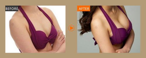 2023合肥鼻唇溝注射肉毒素權(quán)威專家排行前十強(qiáng)(高嫣、李明、趙雅玲榜一優(yōu)先登頂)