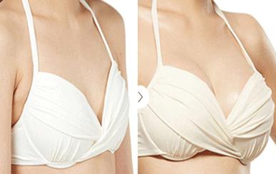 2023南京線雕去魚尾紋權(quán)威醫(yī)生排行榜前10位(楊苓山、劉寧、朱臺航價格便宜又實用)