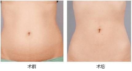 2023湘潭彩光美白嫩膚專家前10位排行榜(劉佑文、熊宜文、熊志能幫你圓夢)