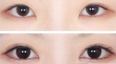 深圳市哪家美容醫(yī)院好？全面評(píng)測(cè)揭曉，服務(wù)和口碑都在線！