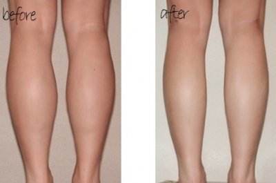 2023蘇州改善下眼皮皺紋醫(yī)生TOP10排名(陳華、江華、尹飛更有名氣)