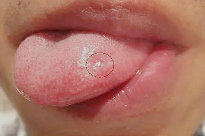 2023深圳細胞填充眼袋排名榜top10強的專家(鄭旭東、雷玉琳、鄒銳靠譜不踩雷~)