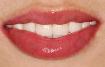 2023鄭州玻尿酸注射祛疤專家在榜名單前十位(馬中望、張艾迪、陳秀娟前三的口碑排名推薦)