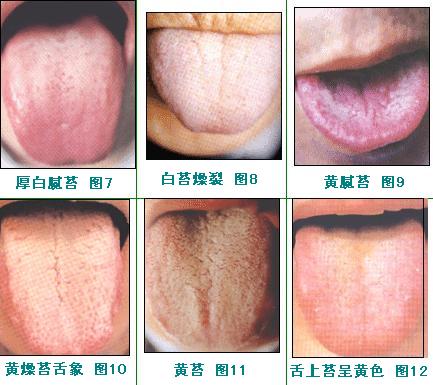 2023通遼下眼袋吸脂肪前10名專家強(qiáng)榜(李笙明、王雪艷、賴炳文優(yōu)勢顯著)