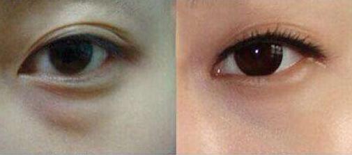 上海更受推薦的隆胸專家排行榜！王濤、江華等5位魅力無限，非常靠譜！