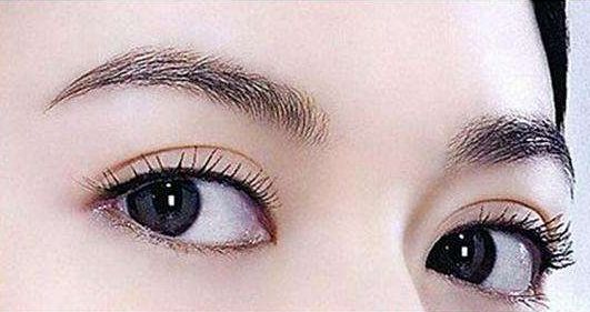 深圳哪家醫(yī)院的雙眼皮手術(shù)效果好？