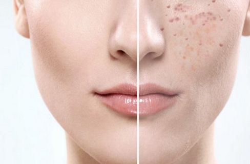 福建泉州海峽醫(yī)療美容醫(yī)院怎么樣？福建泉州海峽醫(yī)療美容醫(yī)院簡(jiǎn)介|醫(yī)生團(tuán)隊(duì)|口碑評(píng)價(jià)！