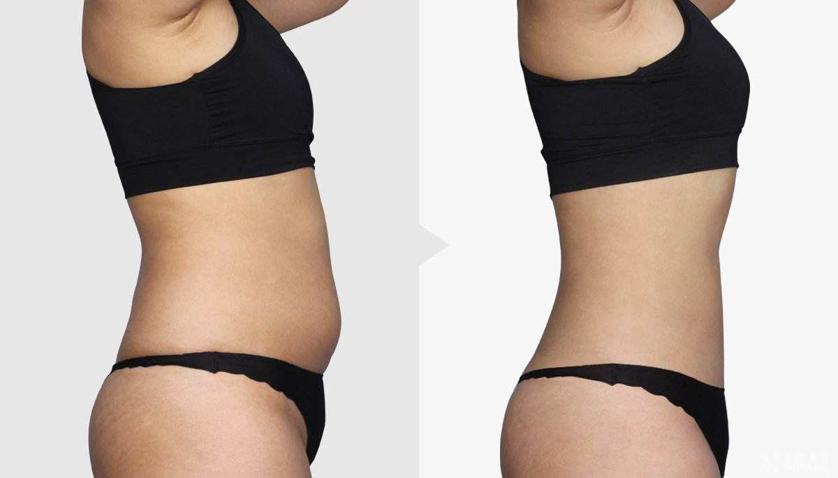 2023黃石玻尿酸原液正規(guī)醫(yī)生評(píng)分前幾(彭靜、楊天赤、步長龍等都是不錯(cuò)的醫(yī)生！)