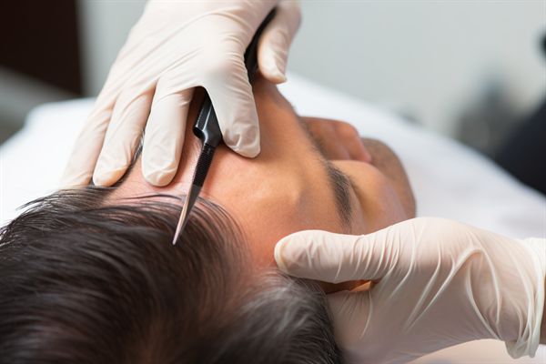 長沙法令紋玻尿酸填充專家推薦：十大名醫(yī)精挑細(xì)選！