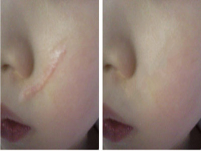 2023鄭州隆鼻線雕排名榜前10名的專家(王慧君、孔宇、李曉娟新版醫(yī)生名單上線)