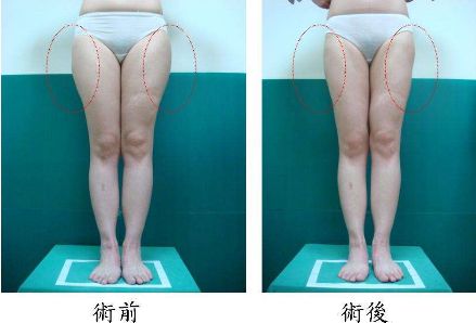 昆明哪家治痘痘好的醫(yī)院，痘痘問題如何有效解決？