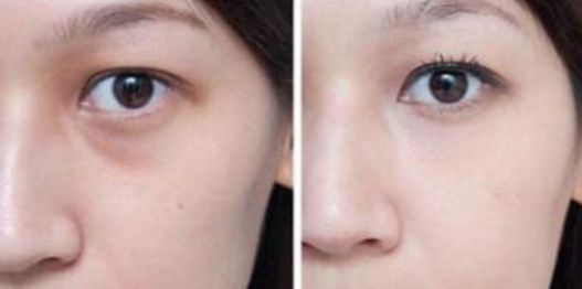 武漢看胎記醫(yī)院哪家好？綜合醫(yī)療機(jī)構(gòu)排行榜詳細(xì)解讀