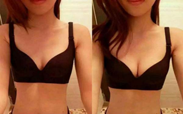 2023天津膠原蛋白填充臉頰專家上榜名單前十強(qiáng)(劉鳳強(qiáng)、崔長(zhǎng)信、劉俊實(shí)力不輸公立)