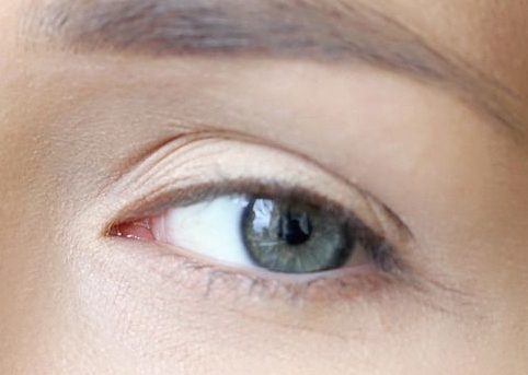 2023孝感美白導(dǎo)入醫(yī)生上榜前十名(嚴(yán)飛、楊白蘭、鄧昵實(shí)力靠譜口碑佳)