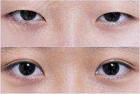 2023成都射頻祛靜態(tài)紋權(quán)威醫(yī)生排行前10名(汪國義、藍安惠、陳衛(wèi)華嚴選專家，實力過硬！)