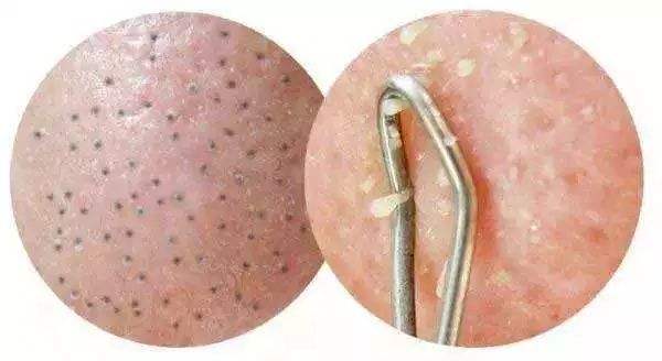 2023蕪湖韓式唯美無痕隆胸排行榜前10強專家(曹晗、杜姜、張輝都是值得信賴的醫(yī)生)