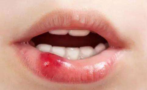 2023銅仁治療酒糟鼻top10強的專家(肖鈺柱、劉大琨、龔武斌從評價看挺正規(guī))