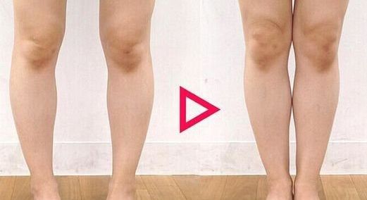 南昌二附院整形科腰腹吸脂是否可靠？醫(yī)生專業(yè)解讀幫您解答