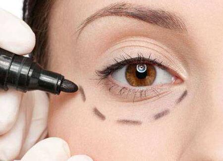 蘇州哪位醫(yī)生修復雙眼皮失敗靠譜？案例分享有人氣！