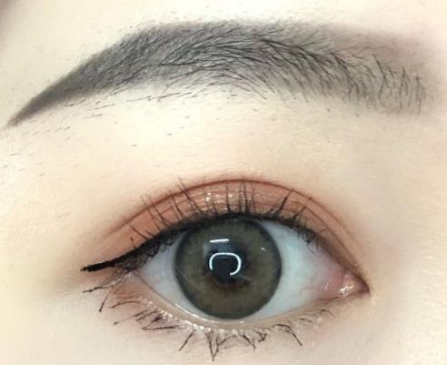 成都哪家美容醫(yī)院的埋線減肥效果好？