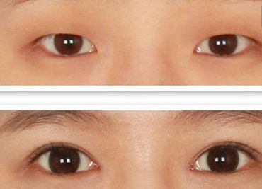 鄭州哪家美容醫(yī)院正規(guī)且口碑好？