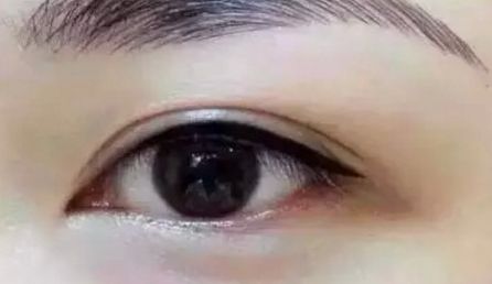 福州秀清醫(yī)療美容整形醫(yī)院的資質(zhì)和口碑怎么樣？