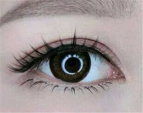 廣州王旭彬鼻子整形效果揭秘，與真人照片對比，令人驚艷的側(cè)顏！