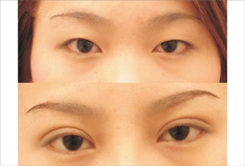 2023烏魯木齊內(nèi)窺鏡除皺去細(xì)紋正規(guī)專家口碑TOP10強(qiáng)(吳偉霞、王春利、蘇炳云概況、技術(shù)、口碑分析)