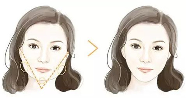 2023沈陽注射填充豐臉頰評分前10位專家(房紅超、高國林、孟強(qiáng)前三上榜理由推薦閱讀)