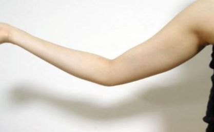 北京聯(lián)合麗格拉皮手術(shù)價(jià)格是多少？楊大平醫(yī)生的口碑如何？