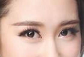 深圳雅函整形醫(yī)院：高山隆鼻術效果一覽，讓你美麗臉龐重煥新生！