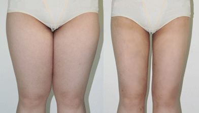 長春治療雀斑哪家醫(yī)院好？雀斑治療哪家醫(yī)院比較靠譜呢？