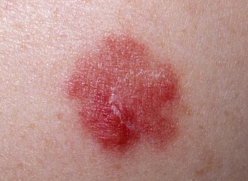 北京鼻修復(fù)醫(yī)生評(píng)價(jià)：劉彥軍、薛軼群技術(shù)對(duì)比，附價(jià)格一覽