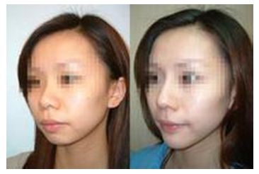 秦皇島美容美體哪家好？刷爆朋友圈的秘密美容院大揭秘！